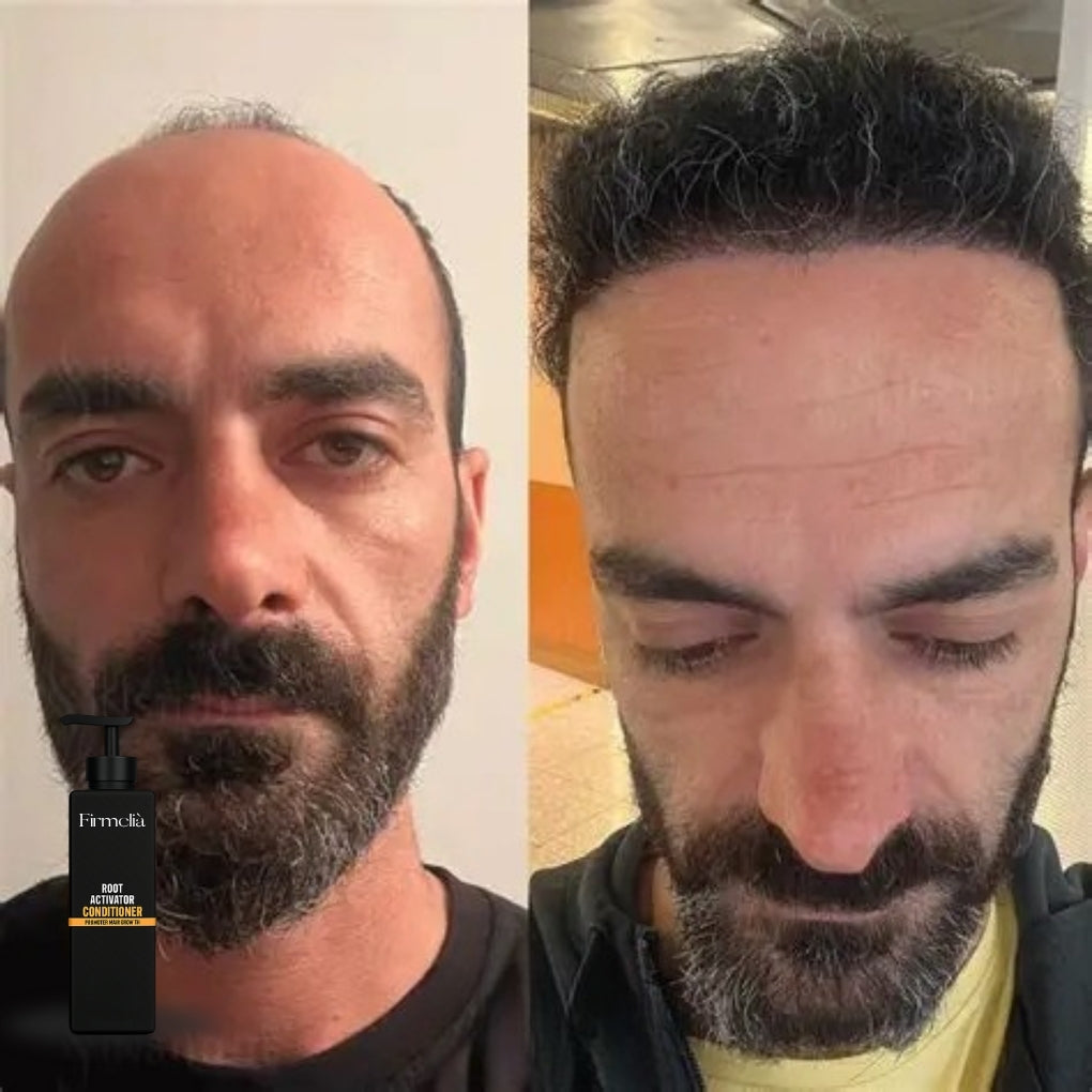 Bálsamo reparador folicular Firmelià