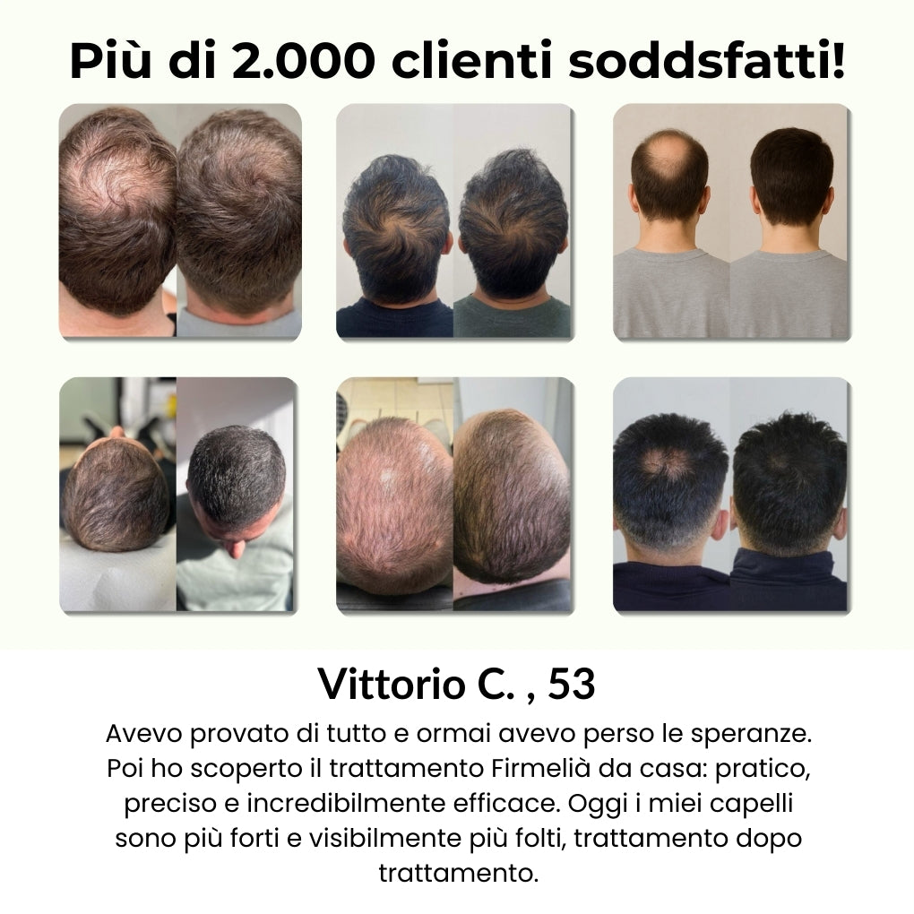 Sistema de Microinfusión Capilar Firmelià PRO®