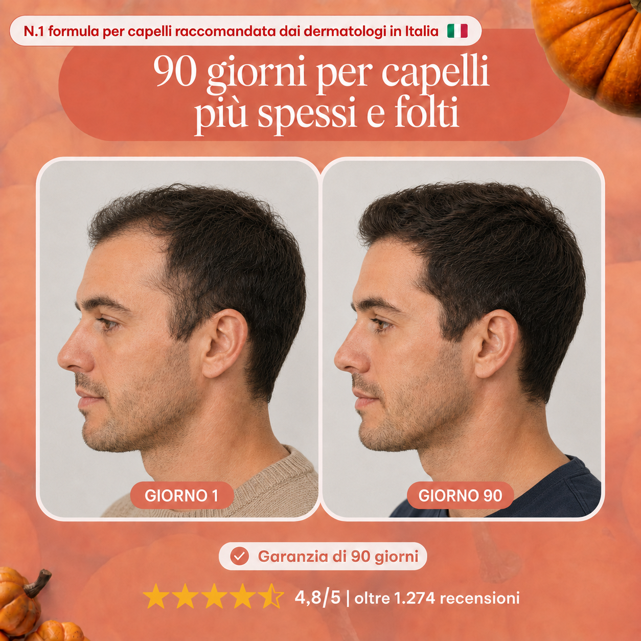 Sistema de Microinfusión Capilar Firmelià PRO®